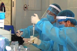  Xét nghiệm khẳng định virus SARS-CoV-2 bằng kỹ thuật realtime RT-PCR tại Trung tâm Kiểm soát bệnh tật tỉnh Hà Giang. (Ảnh: TTXVN phát)