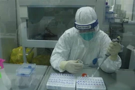 Xét nghiệm COVID-19. (Ảnh: Thanh Thương/TTXVN)