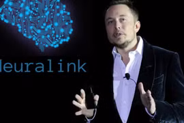 Ellon Musk hé lộ thông tin đặc sắc về người đầu tiên được cấy chip não Neuralink