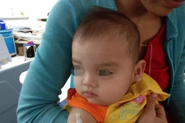 Bệnh nhi sau khi đã được phẫu thuật cắt bỏ hoàn toàn khối bướu. (Ảnh: TTXVN phát)