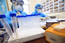 Lấy mẫu xét nghiệm SARS-CoV-2. (Ảnh: TTXVN)