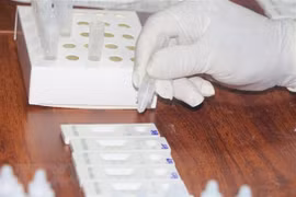 Xét nghiệm test nhanh SARS-CoV-2. (Ảnh: Bích Huệ/TTXVN)