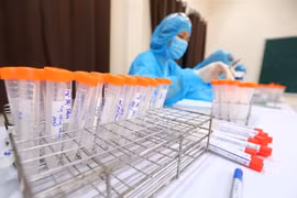 Lấy mẫu xét nghiệm COVID-19. (Nguồn: TTXVN)