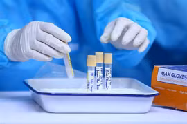 Lấy mẫu xét nghiệm SARS-CoV-2. (Ảnh: TTXVN)