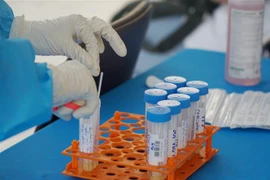 Lấy mẫu xét nghiệm SARS-CoV-2. (Ảnh: TTXVN)