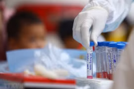 Lấy mẫu xét nghiệm SARS-CoV-2. (Ảnh: TTXVN)