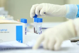 Mẫu xét nghiệm SARS-CoV-2. (Nguồn: TTXVN)