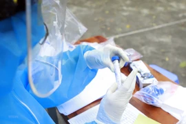 Lấy mẫu xét nghiệm SARS-CoV-2. (Ảnh: TTXVN)