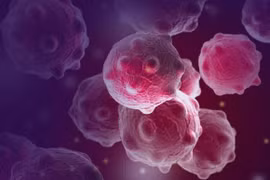 Sanofi ngừng phát triển chất amcenestrant điều trị ung thư vú