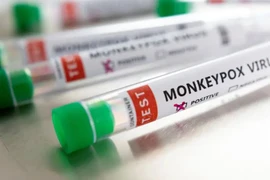 Israel phát hiện thêm một trường hợp nhiễm đậu mùa khỉ