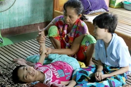 Nạn nhân chất độc da cam. (Ảnh: Dương Ngọc/TTXVN)