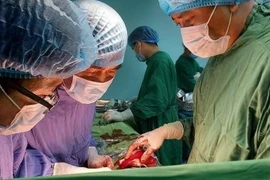 Phẫu thuật thành công cho bệnh nhân mang khối u sarcoma 'khổng lồ'