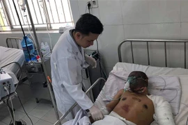 Tài xế xe bồn Thạch Vân bị bỏng nặng vùng mặt, lưng, cổ và tứ chi đang được chăm sóc đặc biệt. (Ảnh: Đinh Hằng/TTXVN)