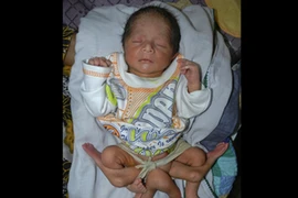 Bé trai có gen hiếm gặp. (Nguồn: Internet)