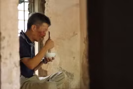 Căn bệnh quái ác khiến ông Sứ trở nên cô độc, sống khép kín suốt hơn 10 năm trời.