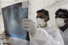 Kiểm tra phim chụp X-quang bệnh nhân nhiễm virus H1N1 tại bệnh viện ở Ahmedabad, Ấn Độ ngày 12/3/2013. Ảnh minh họa. (Nguồn: AFP/TTXVN)