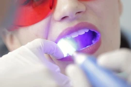 Bước tiến mới trong phát triển vật liệu điều trị nha khoa