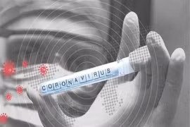 Mẫu bệnh phẩm của bệnh nhân nhiễm COVID-19. (Ảnh: IRNA/TTXVN)