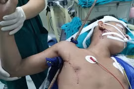 Bệnh nhân sau ca phẫu thuật cấp cứu. (Ảnh: TTXVN phát)