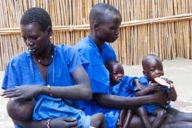Trẻ em bị suy dinh dưỡng tại Ganyiel, quận Panyijiar, Nam Sudan. (Nguồn: AFP/TTXVN) 