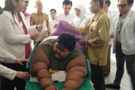 Cậu bé béo nhất thế giới Arya Permana. (Ảnh: Trần Chiến/Vietnam+)