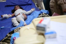 Trẻ em được điều trị tại bệnh viện sau khi IS nã rocket có chứa chất hóa học vào thị trấn Taza, phía Bắc thành phố Kirkuk. (Nguồn: AFP/TTXVN)