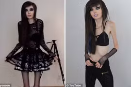 Eugenia Cooney với thân hình gầy gò đáng lo ngại. (Nguồn: DailyMail)