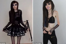 Eugenia Cooney với thân hình gầy gò đáng lo ngại. (Nguồn: DailyMail)