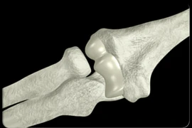 Ảnh minh họa. (Nguồn: coviet.vn)