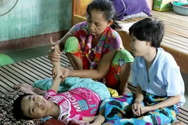 Nạn nhân chất độc da cam. (Ảnh: Dương Ngọc/TTXVN)