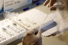 Xét nghiệm các mẫu bệnh phẩm. (Ảnh: TTXVN/Vietnam+)