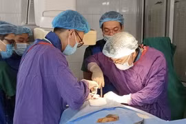 Các bác sỹ phẫu thuật cho bệnh nhân. (Ảnh: PV/Vietnam+)