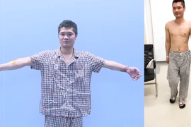 [Mega Story] Việt Nam ghi dấu ấn mới trên bản đồ y khoa thế giới 