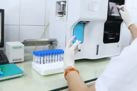 Ảnh minh họa. (Ảnh: PV/Vietnam+)