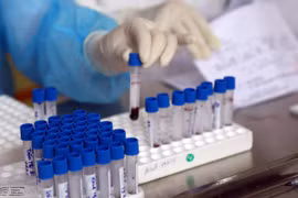 Lấy mẫu máu xét nghiệm COVID-19. (Ảnh: TTXVN/Vietnam+)