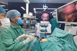 Điều trị nang ống mật chủ bằng nội soi một lỗ là kỹ thuật đặc biệt khó. (Ảnh: PV/Vietnam+)