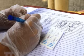 Mẫu bệnh phẩm với kết quả xét nghiệm COVID-19. (Ảnh: TTXVN/Vietnam+)