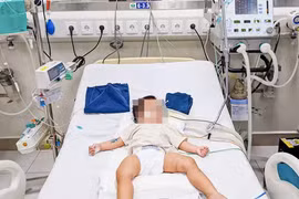 Bé gái đang được điều trị tại Bệnh viện Nhi Trung ương. (Ảnh: BVCC)