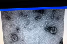Viện vệ sinh dịch tễ Trung ương đã nuôi cấy và phân lập thành công virus corona mới.