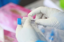 Nhân viên y tế làm công tác lấy mẫu xét nghiệm COVID-19. (Ảnh: TTXVN/Vietnam+)