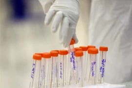 Lấy mẫu xét nghiệm COVID-19. (Ảnh: TTXVN/Vietnam+)