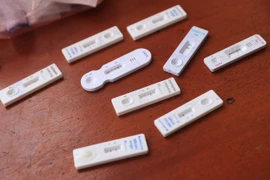 Các mẫu test SARS-CoV-2. (Ảnh: TTXVN/Vietnam+)