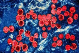 Hình ảnh virus đậu mùa khỉ dưới kính hiển vi. (Ảnh: Getty Images/TTXVN)