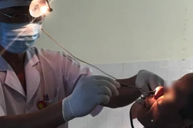 Nội soi gắp con đỉa còn sống dài 6cm ra khỏi mũi bệnh nhân 