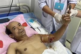 Sau 10 ngày phẫu thuật, hiện tại cánh tay nối được tưới máu tốt, hồng hào trở lại, vết nối khô. (Ảnh: TTXVN phát)