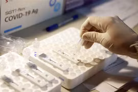 Nhỏ mẫu bệnh phẩm để test COVID -19 tại khu vực xét nghiệm COCID -19 lưu động tại đường lên Tam Đảo. (Ảnh: Hoàng Hùng/TTXVN)