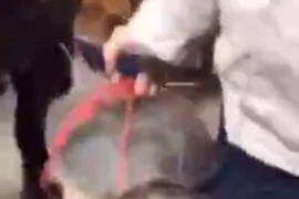 [Video] Người đàn ông đen đủi bị con rùa cắn vào chỗ "nhạy cảm"