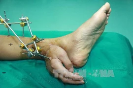 Kỳ lạ chàng trai có bàn tay mọc gần...bàn chân