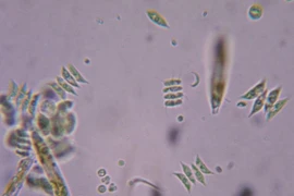 Phát hiện loại virus có khả năng khiến con người trở nên ngu ngốc