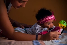 Em bé bị mắc chứng đầu nhỏ tại thủ đô Quito, Ecuador. (Nguồn: THX/TTXVN)